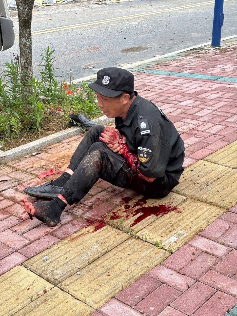 6.17，湖南桂东，疯狗咬人.jpg